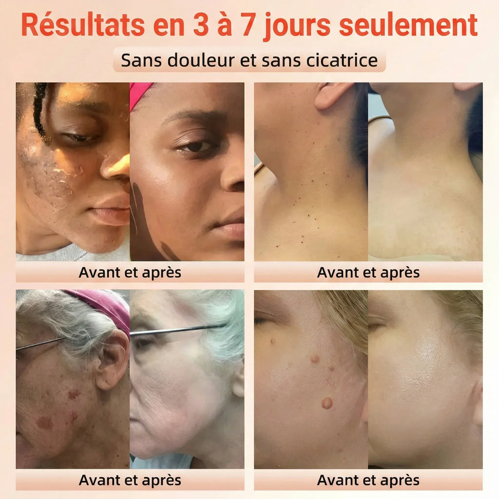 GEL EXFOLIANT ECLAIRCISSANT ET ANTI-TACHES